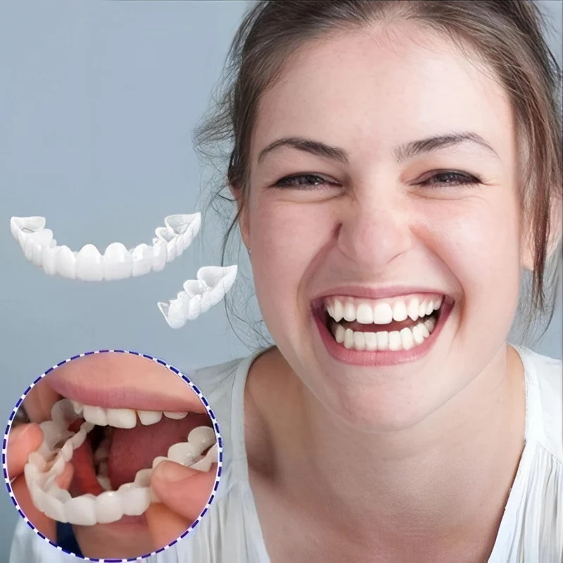 Cosmetische Tandenschalen Set Boven & Onder voor Stralende Glimlach Persoonlijke Tandverzorging Thuis | Sansoti