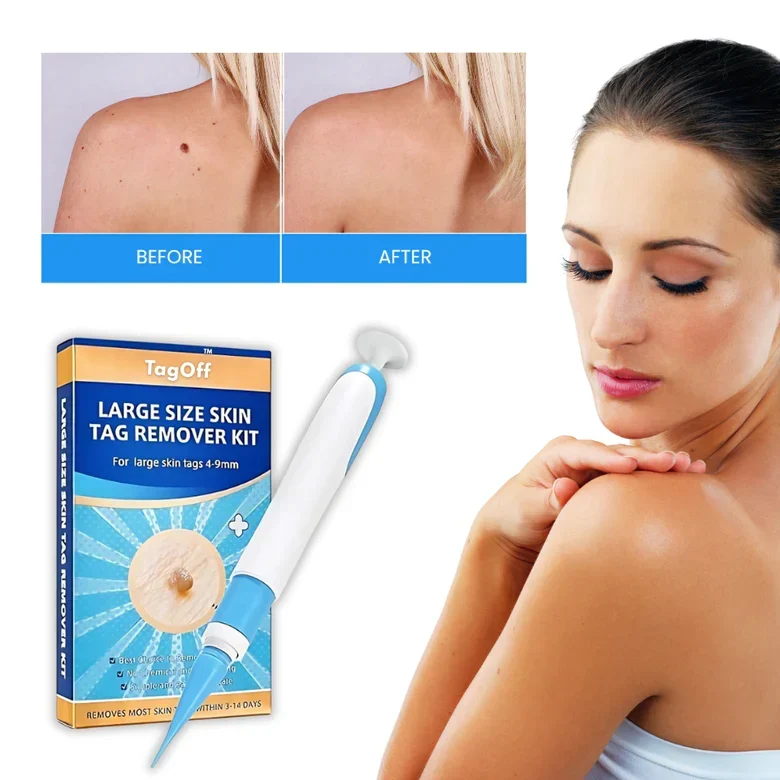Huidverzorgingsformule 30ml met Precisie-applicator en Natuurlijk Extract voor Gerichte Huidverzorging | Sansoti