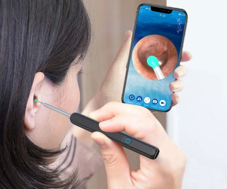 Oorexamen Camera met Siliconen Reinigingsopzetstuk en LED-Verlichting | Sansoti